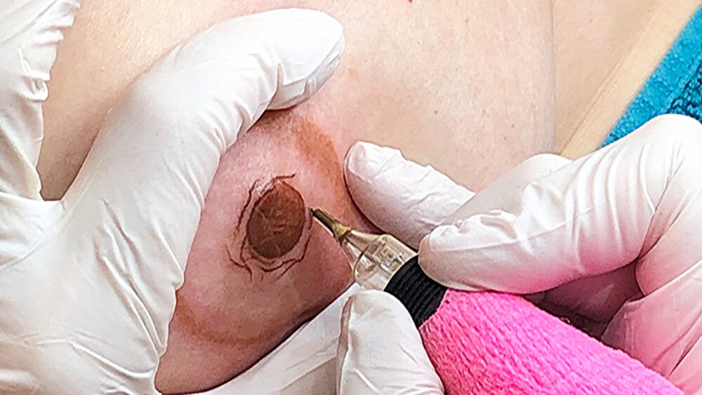 Ausbildung für medizinische Brustpigmentierung Ausbildung für medizinische Brustpigmentierung