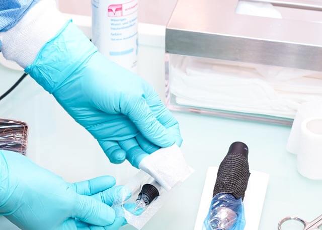 Hygienemaßnahmen-medizinische-pigmentierung-lydia-dwornicki Sterile Einwegnadeln für medizinische Brustpigmentierung